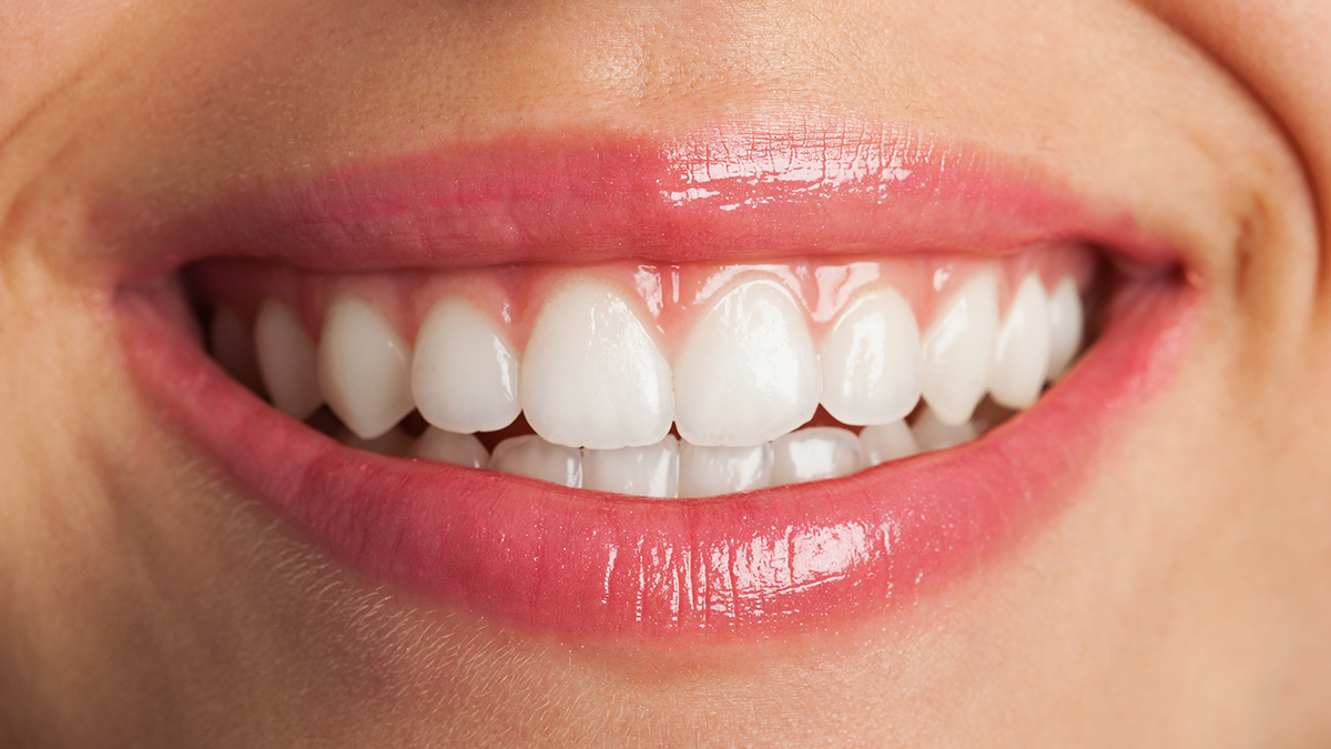 dentes