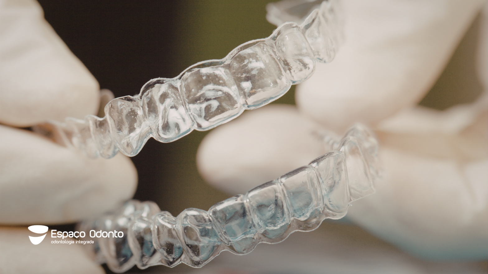 Preço do alinhador transparente