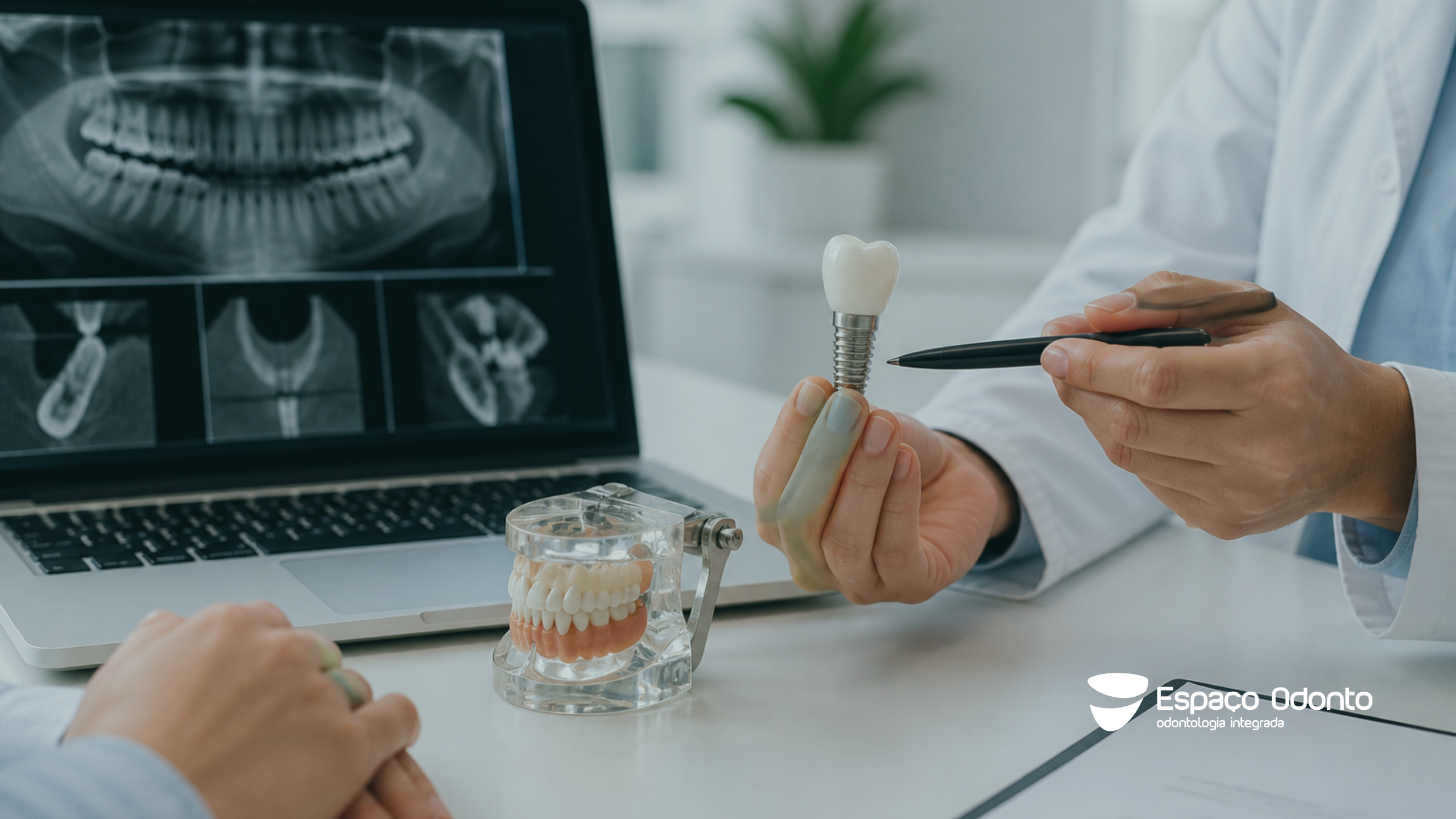 Planejamento de implantes dentários com análise digital e exame de imagem