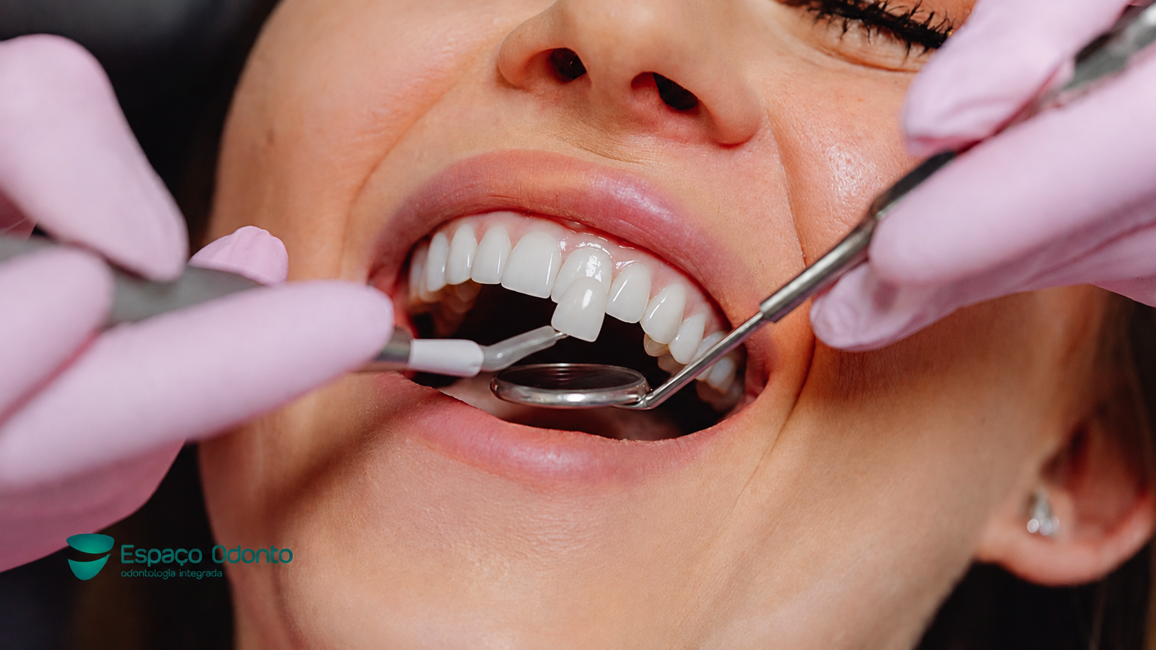 Teste de lente dentaria